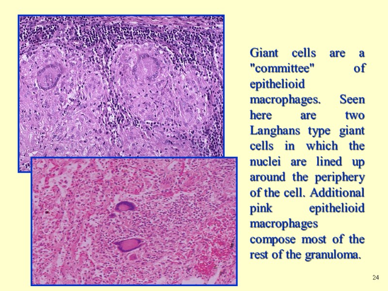 Giant cells are a 